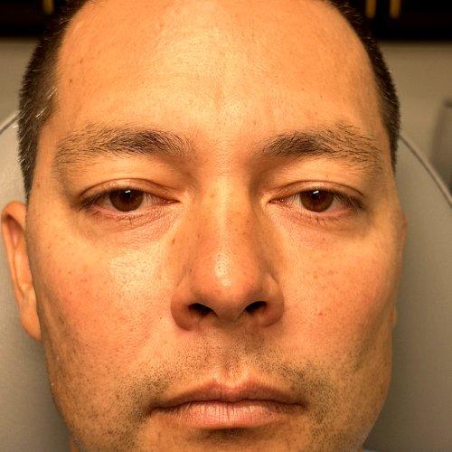 NIMS Medspa after — Houston, TX