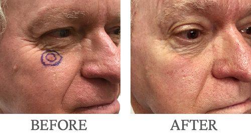 Bopp Dermatology & Facial Plastic Surgery result — Metairie, LA