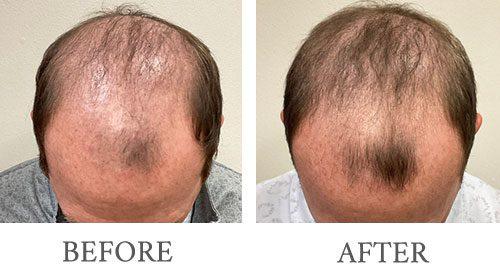 Bopp Dermatology & Facial Plastic Surgery result — Metairie, LA