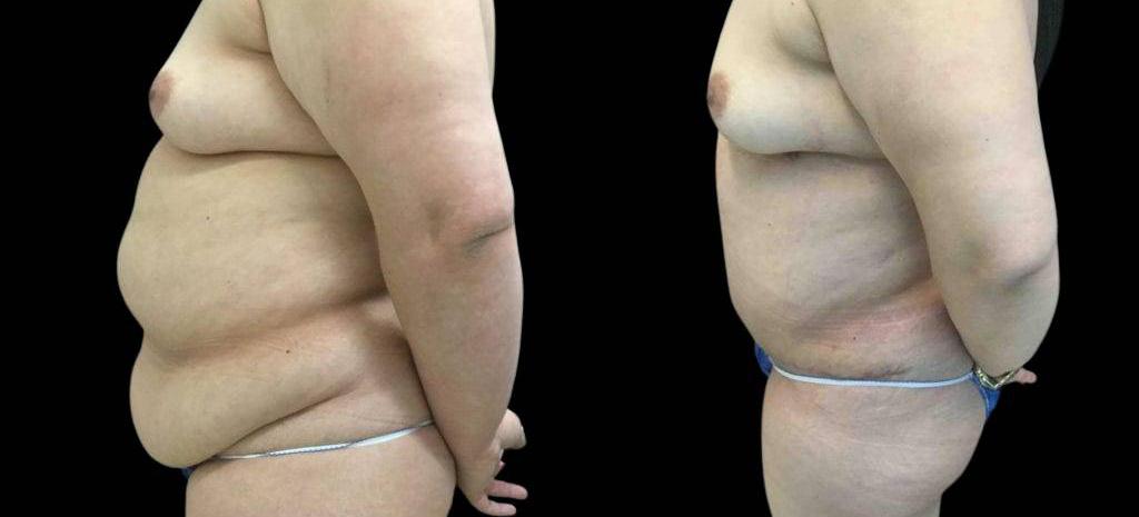 Bitar Cosmetic Surgery Institute & Medspa result — Fairfax, VA