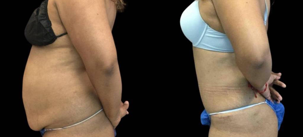 Bitar Cosmetic Surgery Institute & Medspa result — Fairfax, VA