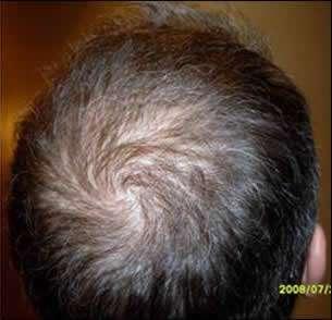 Golden Triangle Facial Plastic Surgery after — San Diego, CA