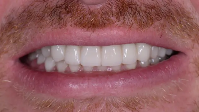 Smile Makers Family and Cosmetic Dentistry: Dr. Caitlin Flosi, DDS provider photo