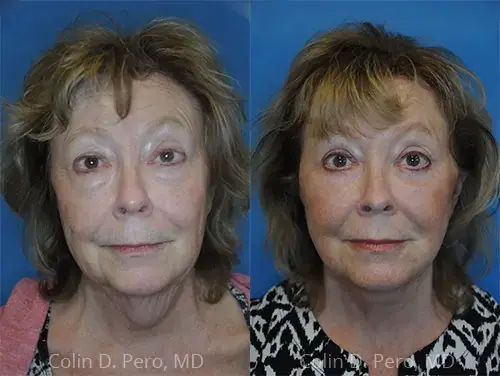 Dr. Colin D. Pero, MD result — Plano, TX