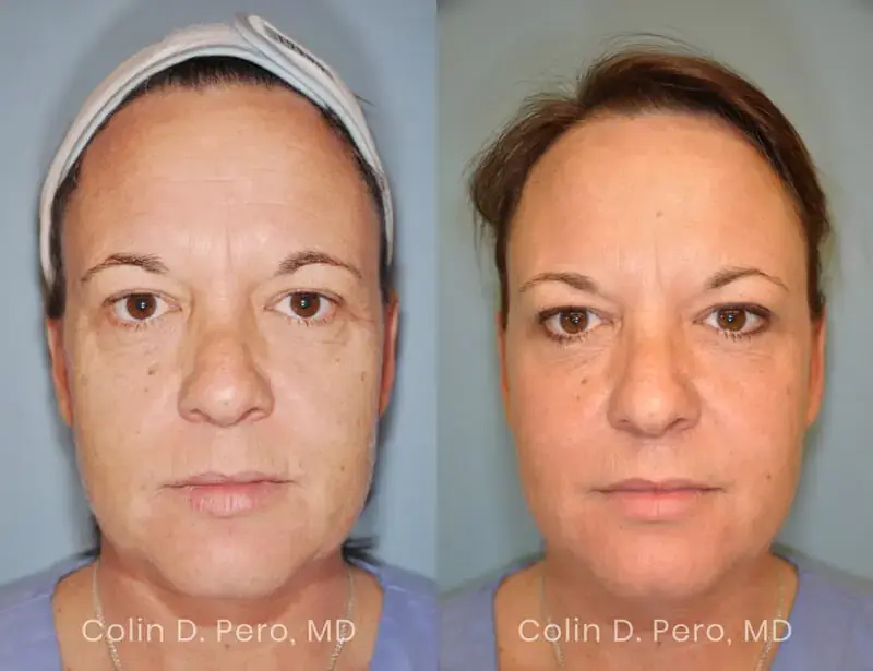Dr. Colin D. Pero, MD result — Plano, TX