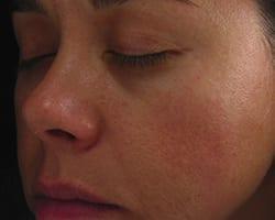 Suddenly Slimmer Med Spa after — Phoenix, AZ