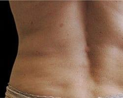 Suddenly Slimmer Med Spa after — Phoenix, AZ