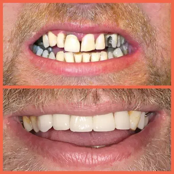 Legacy Dental result — Salt Lake City, UT