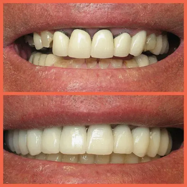 Legacy Dental result — Salt Lake City, UT