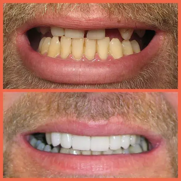 Legacy Dental result — Salt Lake City, UT