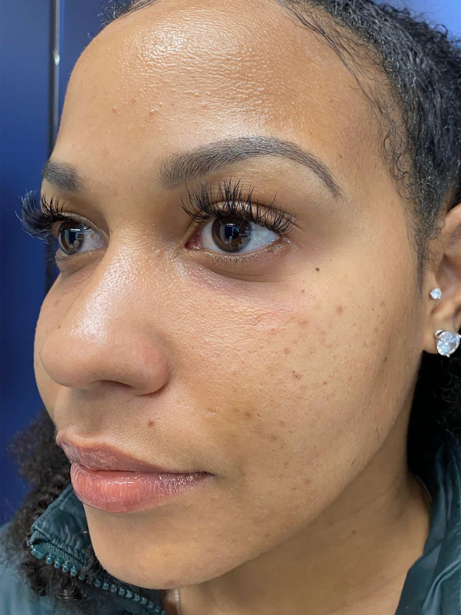 Capital Aesthetic and Laser Center after — Washington, DC