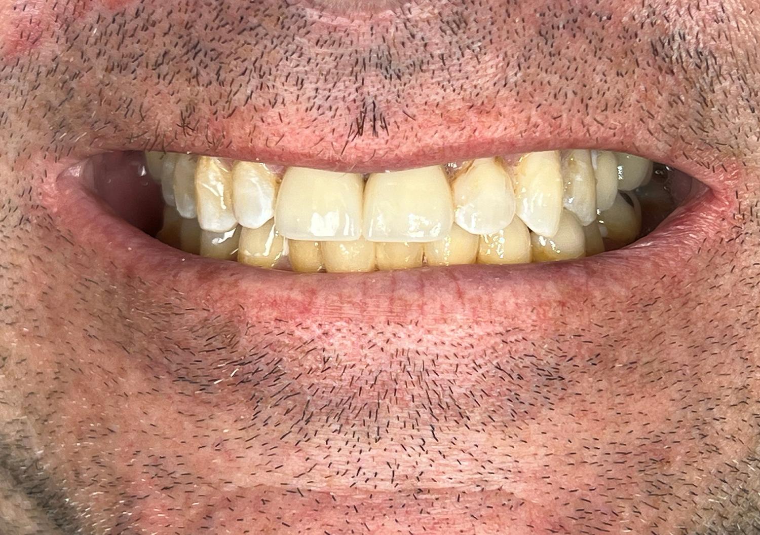 Kierland Dental Studio of Paradise Valley smile makeover after — Scottsdale, AZ