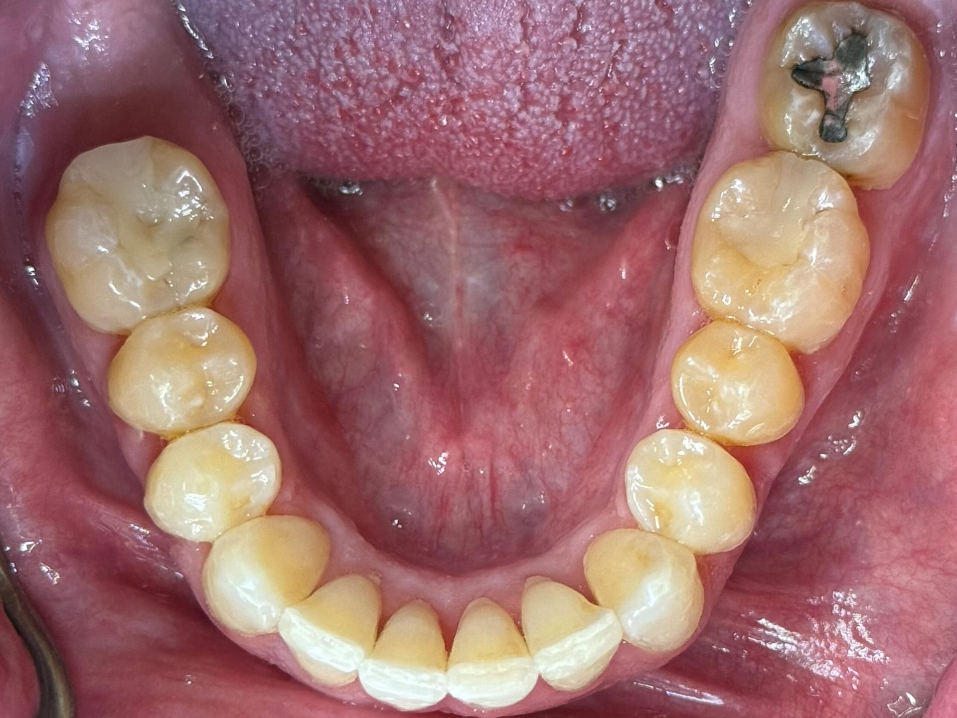 Kierland Dental Studio of Paradise Valley smile makeover after — Scottsdale, AZ