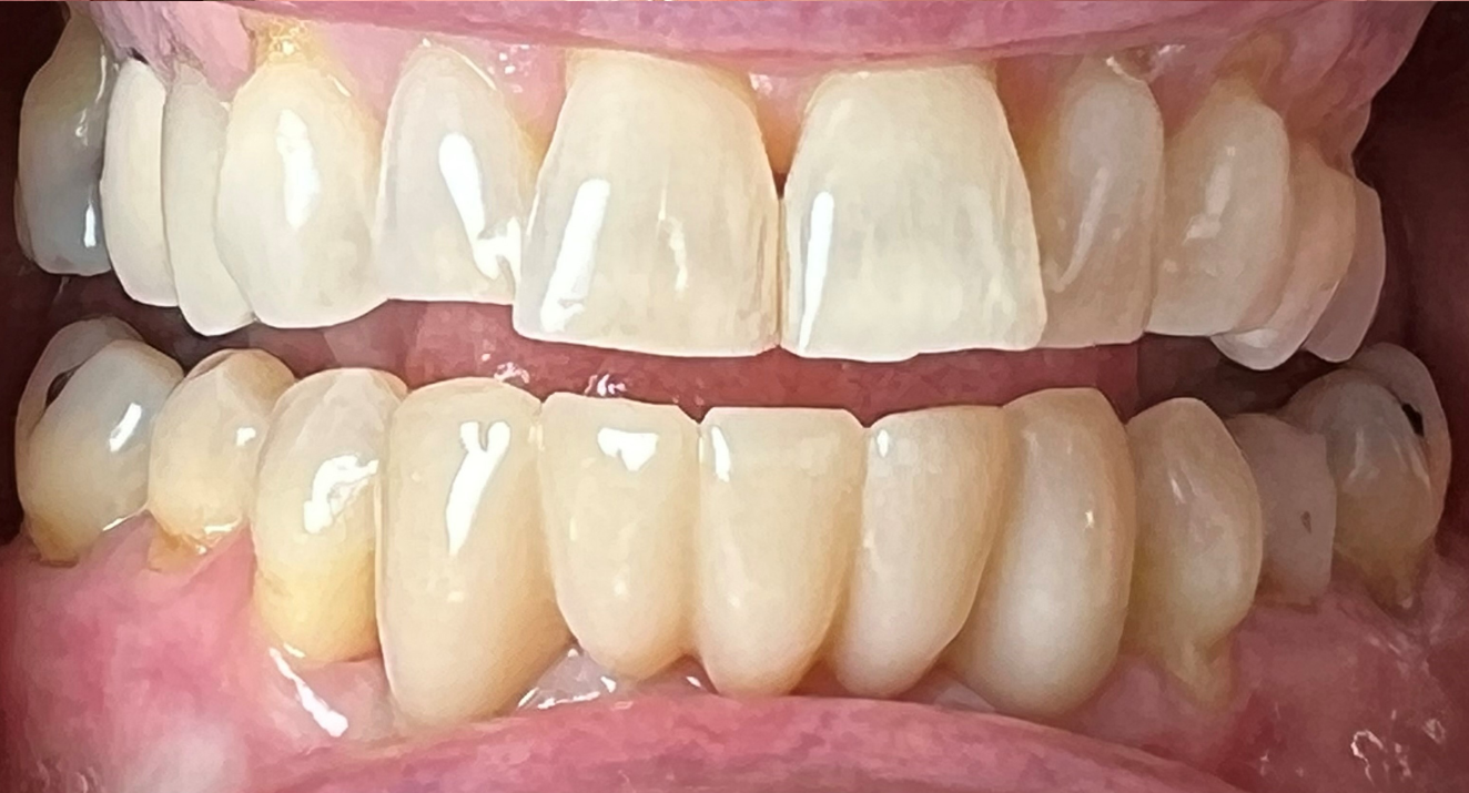 Kierland Dental Studio of Paradise Valley smile makeover after — Scottsdale, AZ