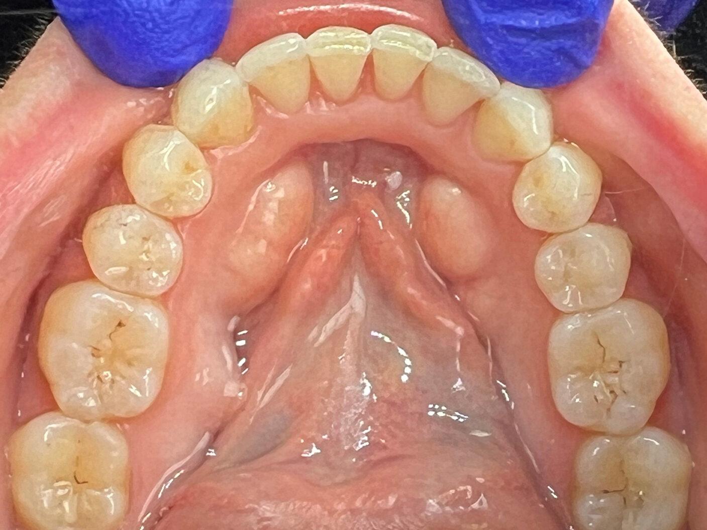 Kierland Dental Studio of Paradise Valley smile makeover after — Scottsdale, AZ