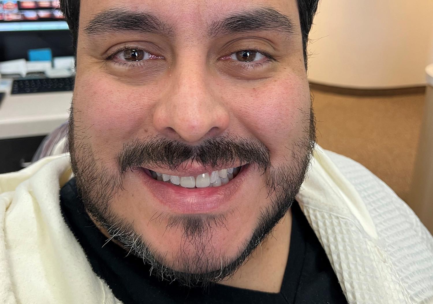 Kierland Dental Studio of Paradise Valley smile makeover after — Scottsdale, AZ