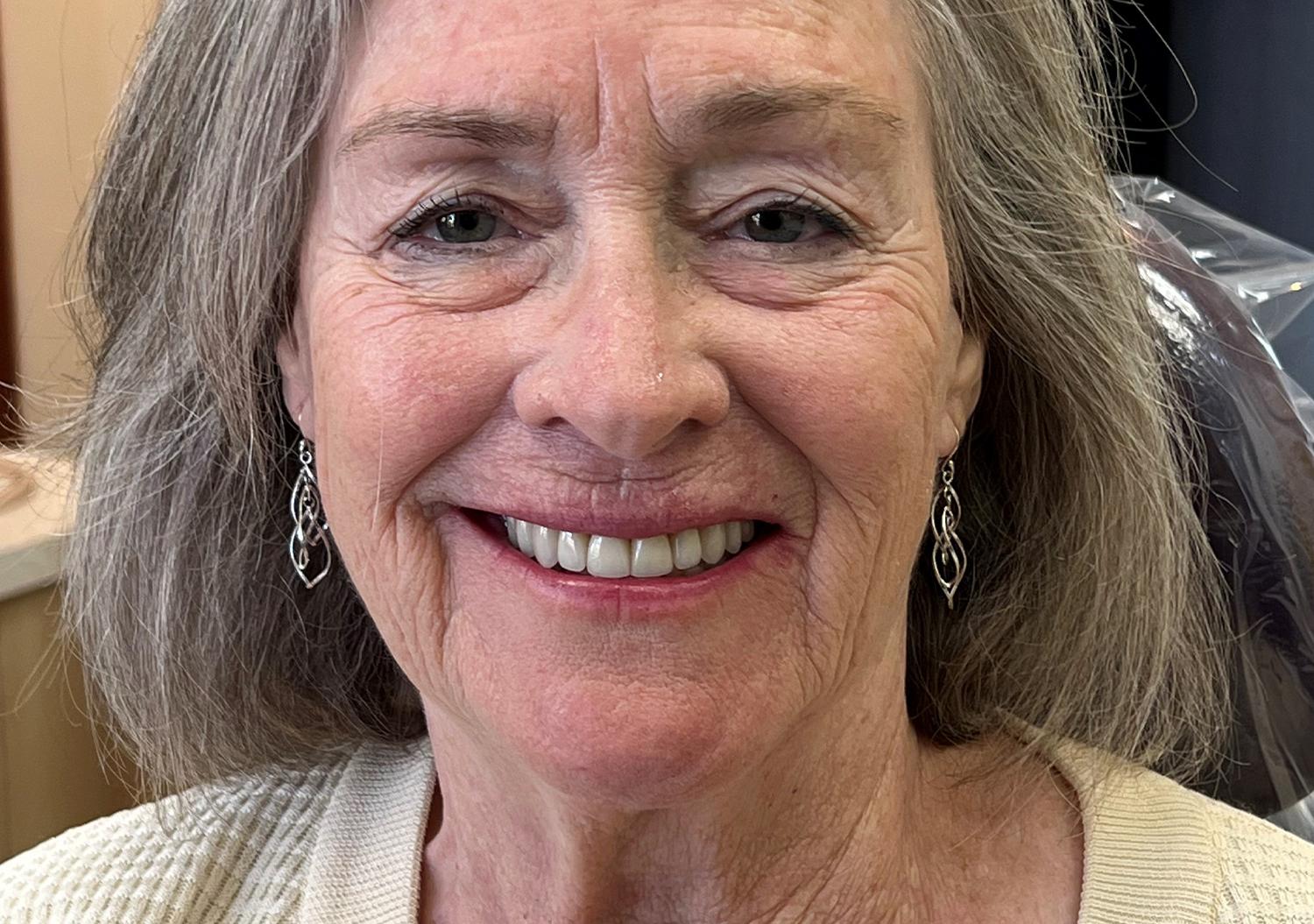 Kierland Dental Studio of Paradise Valley smile makeover after — Scottsdale, AZ