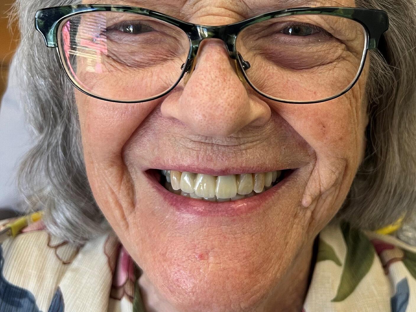 Kierland Dental Studio of Paradise Valley smile makeover after — Scottsdale, AZ