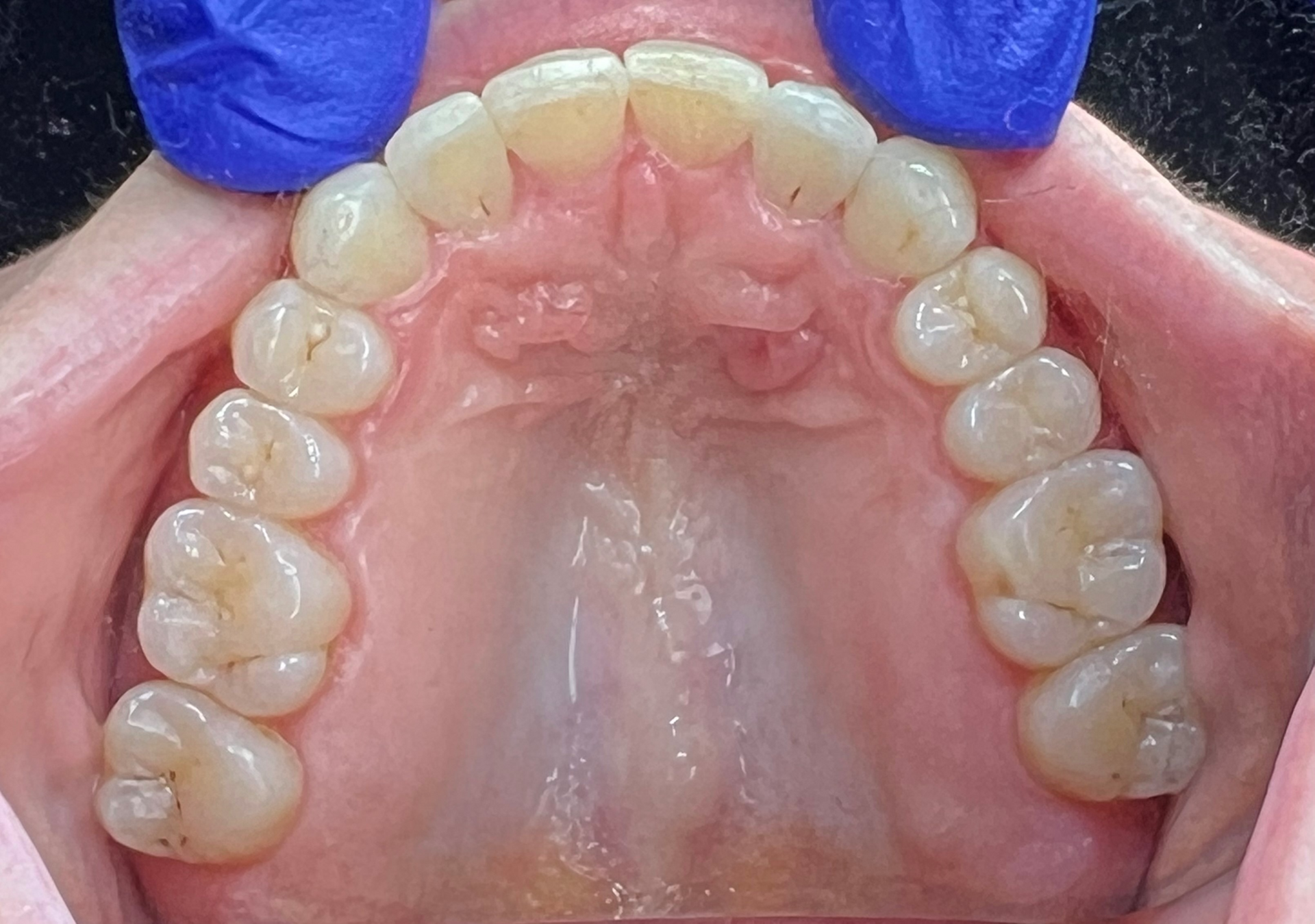 Kierland Dental Studio of Paradise Valley smile makeover after — Scottsdale, AZ