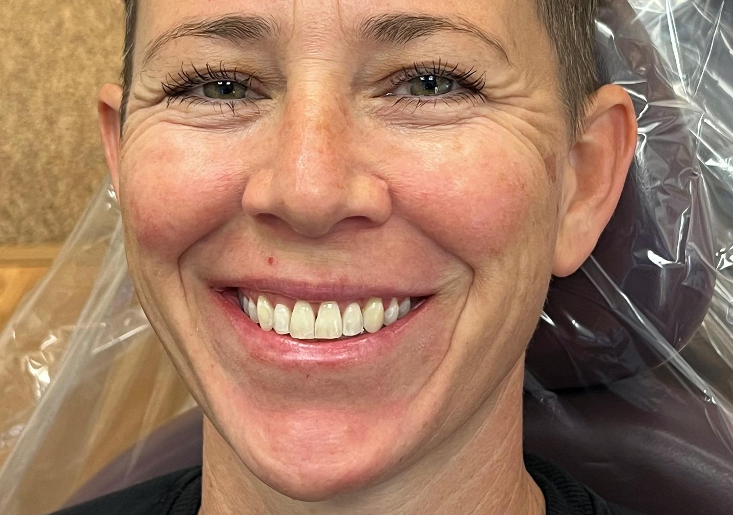 Kierland Dental Studio of Paradise Valley smile makeover after — Scottsdale, AZ