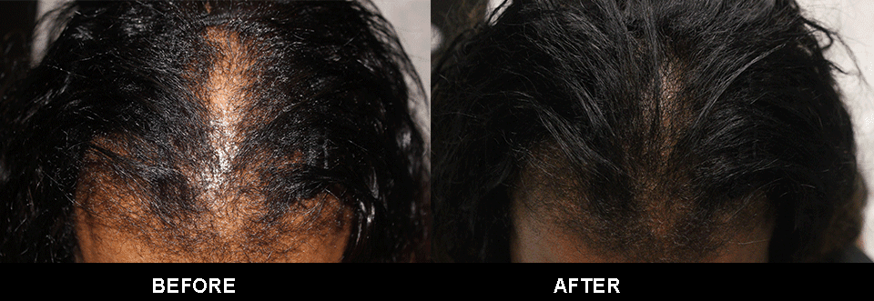 Zinnia Aesthetics and Anti-Aging Clinic result — Fairfax, VA
