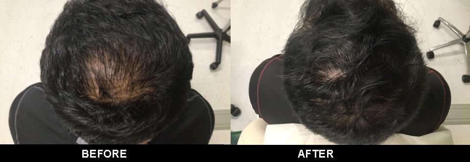 Zinnia Aesthetics and Anti-Aging Clinic result — Fairfax, VA