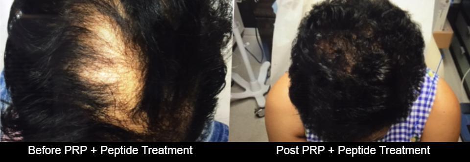 Zinnia Aesthetics and Anti-Aging Clinic result — Fairfax, VA