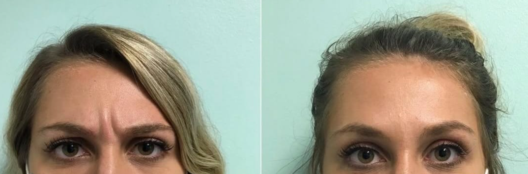 Ageless Remedies SouthPark result — Charlotte, NC