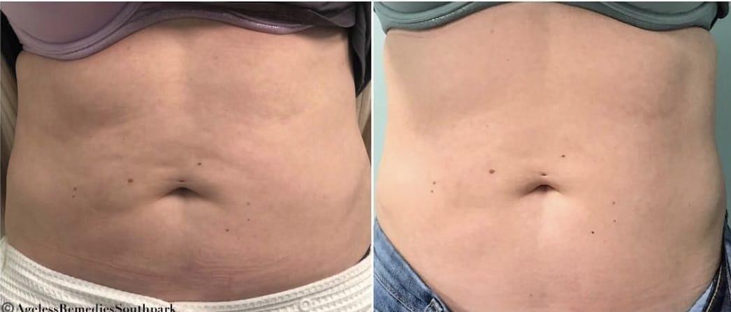 Ageless Remedies SouthPark result — Charlotte, NC