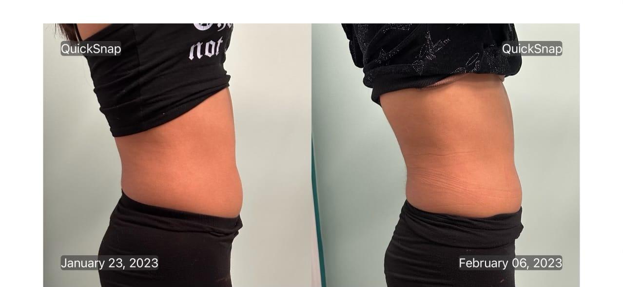 Ageless Remedies SouthPark result — Charlotte, NC