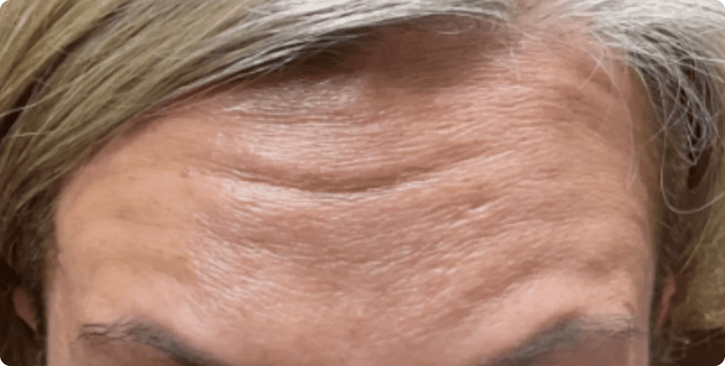 ABQ Medical Spa after — Albuquerque, NM