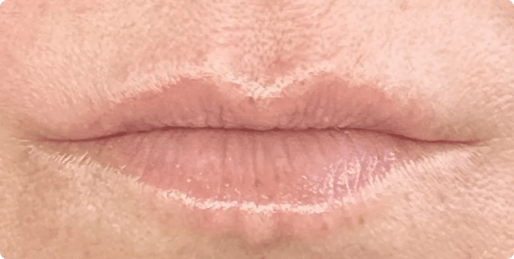 ABQ Medical Spa after — Albuquerque, NM