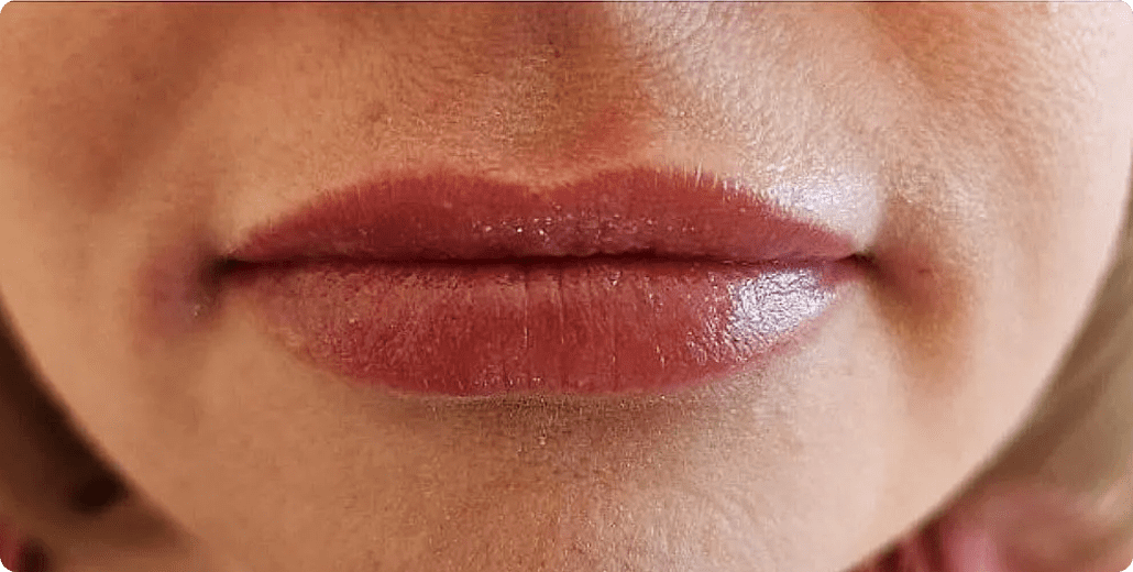 ABQ Medical Spa after — Albuquerque, NM