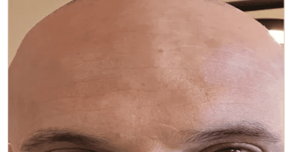 ABQ Medical Spa after — Albuquerque, NM