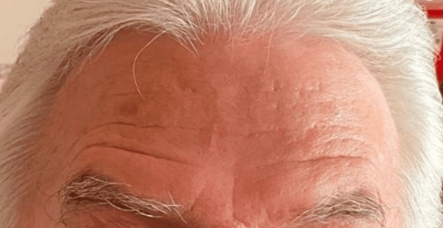 ABQ Medical Spa after — Albuquerque, NM