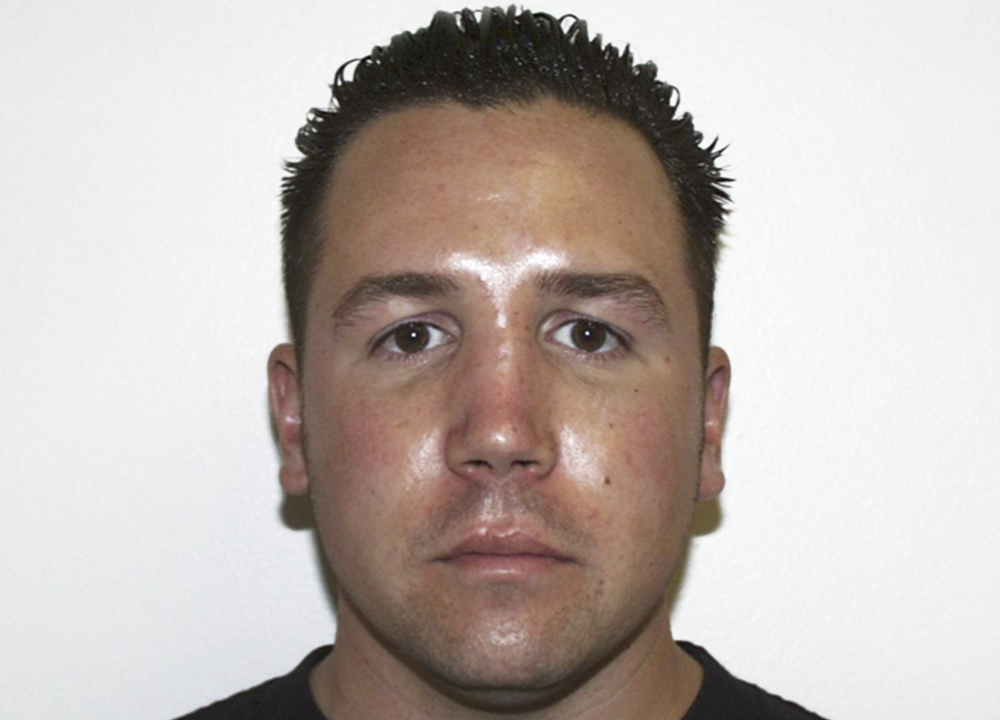Dr. Ron Soltero FACS rhinoplasty after — San Diego, CA