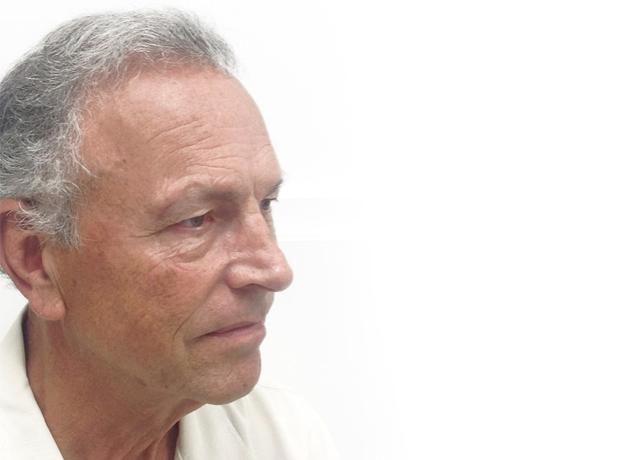 Facelift before at Dr. Ron Soltero FACS in San Diego, CA