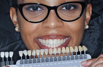 Smile Lab Dallas | Dr. Parihan Tamkin, DDS smile makeover after — Dallas, TX