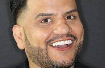 Smile Lab Dallas | Dr. Parihan Tamkin, DDS smile makeover after — Dallas, TX