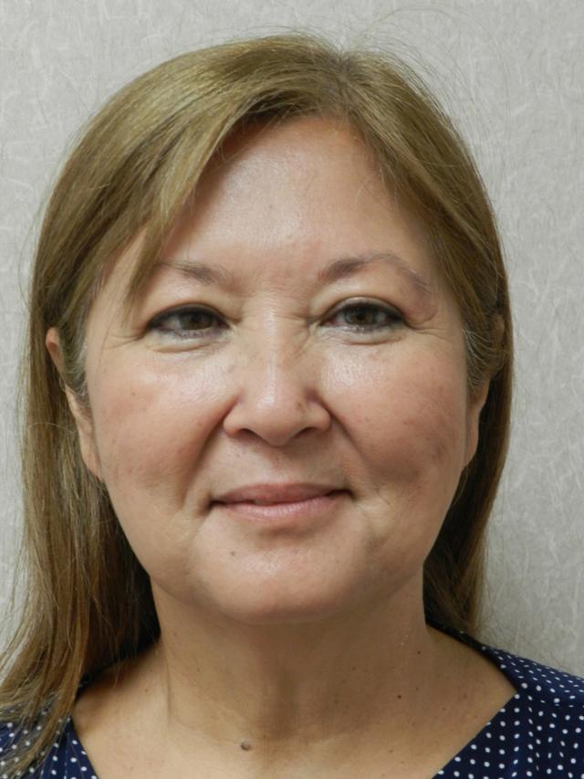 Facelift before at Weston Plastic Surgery (Robert E. Rothfield, MD) in Weston, FL