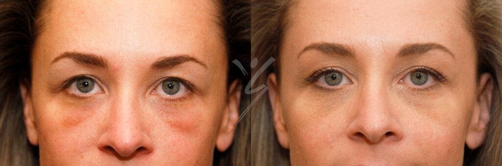 About Faces Cosmetic Surgery and Med Spa result — Tucson, AZ