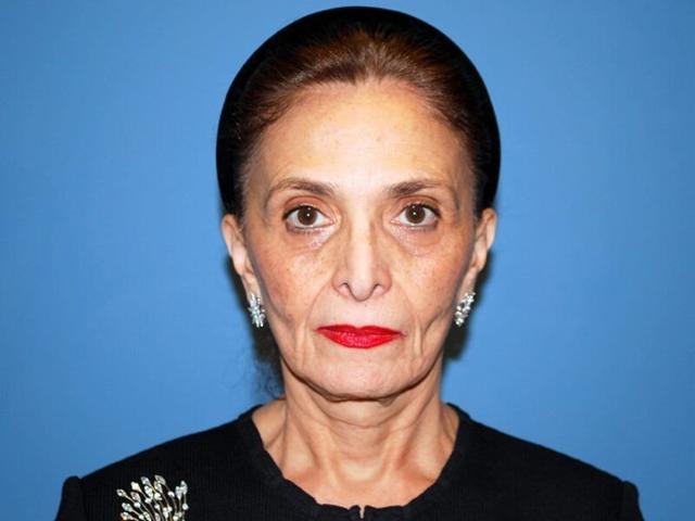 Deep Plane Facelift before at Plastic Surgery Group of Atlanta in Alpharetta, GA