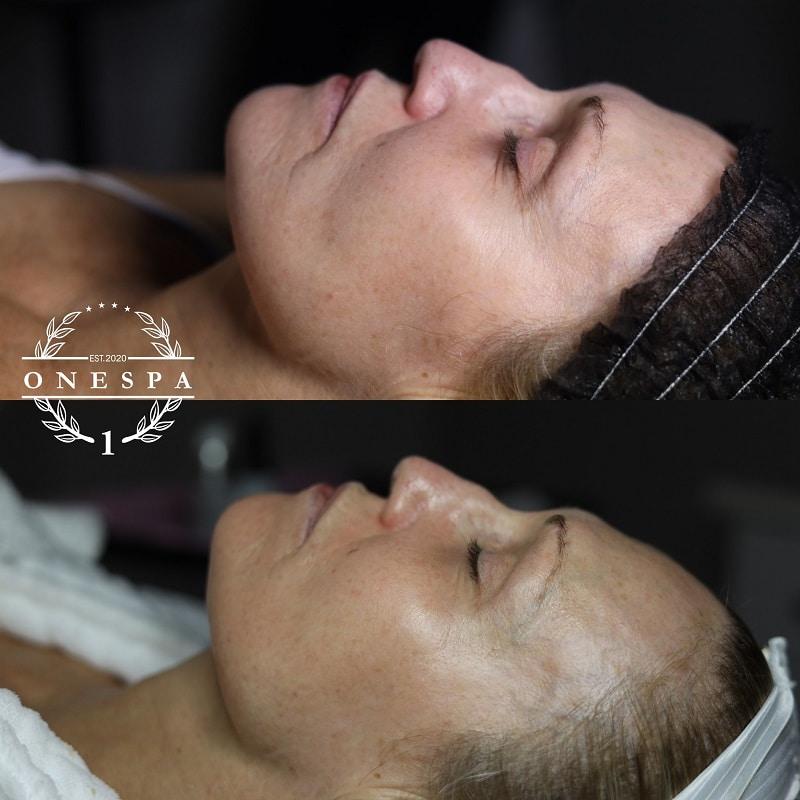The One Spa Chicago result — Chicago, IL