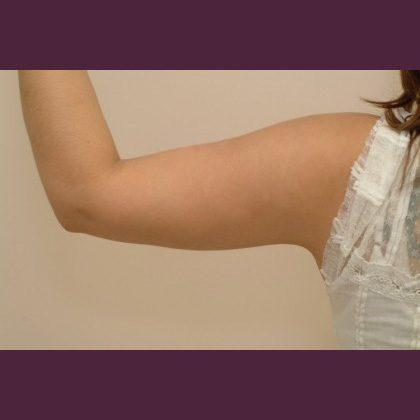 Cosmetic Surgery Associates after — Bethesda, MD