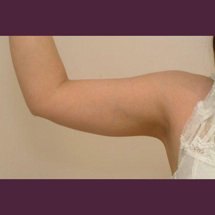 Cosmetic Surgery Associates after — Bethesda, MD