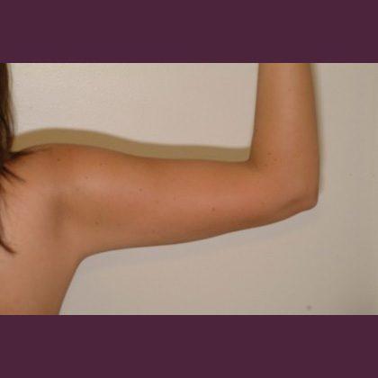 Cosmetic Surgery Associates after — Bethesda, MD
