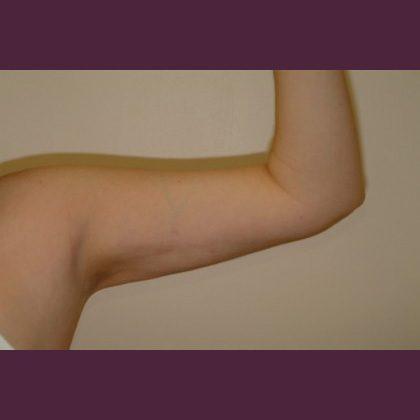 Cosmetic Surgery Associates after — Bethesda, MD