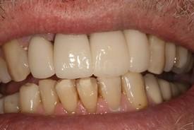 St. George Dental Care after — St. George, UT