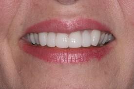 St. George Dental Care after — St. George, UT