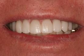 St. George Dental Care after — St. George, UT